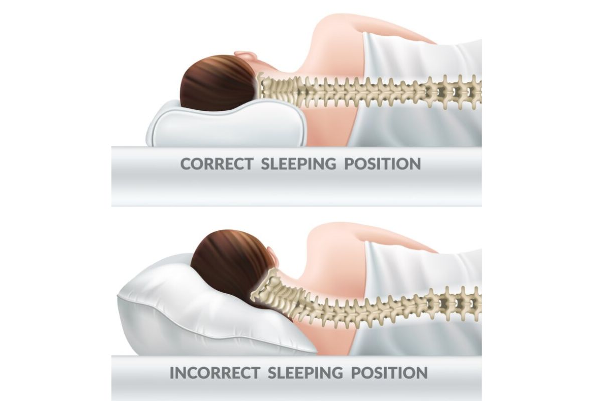 What Is a Soft Mattress? Diagram showing proper and improper spinal alignment to explain how a soft mattress affects sleep posture and support