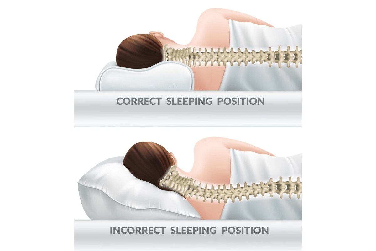 Spinal alignment Spinal alignment